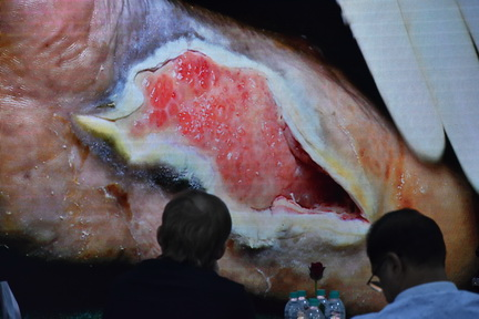 School of Podiatry-20 & 21 March 2025-Live Surgery Sessions