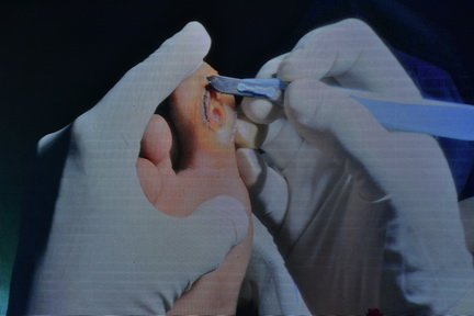School of Podiatry-20 & 21 March 2025-Live Surgery Sessions